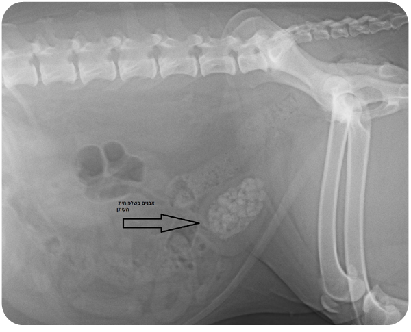 x-ray stones